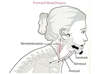 顳下頜關節疾病