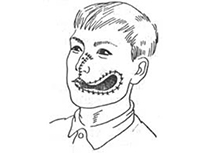 口腔頜面部創傷