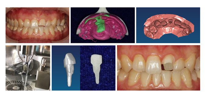 鄧旭亮課題組科研成果成功取得國(guó)家藥監(jiān)局Ⅲ類產(chǎn)品注冊(cè)證
