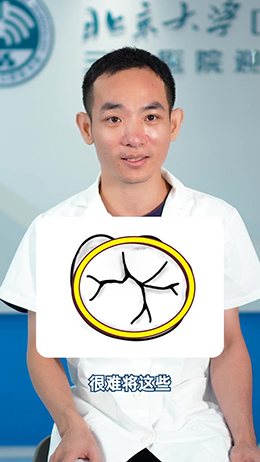 窩溝封閉有必要做嗎?