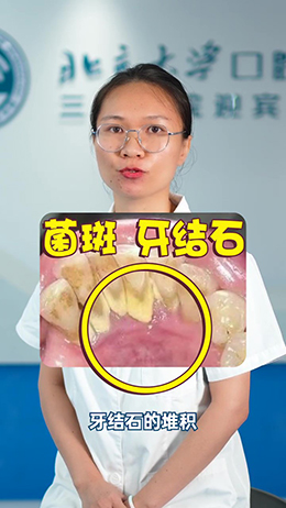 一刷牙就出血?別慌,看看醫生怎么說